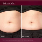 dermalogica dynamic skin sculptor